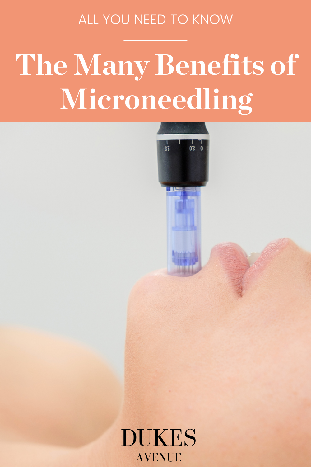 Woman laying down receiving microneedling treatment on her chin, with text overlay 'the many benefits of microneedling'